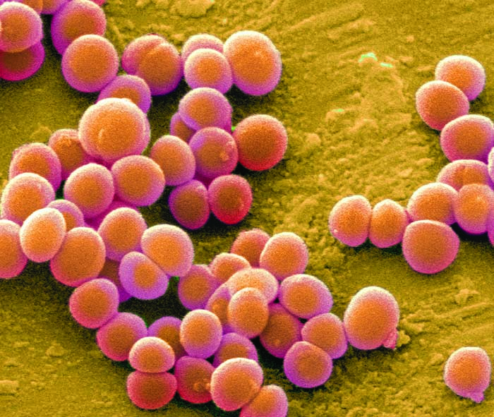 an image of the Methicillin-Resistant Staphylococcus Aureus used to track its evolution and transmission